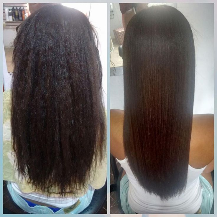 Antes e Depois 1